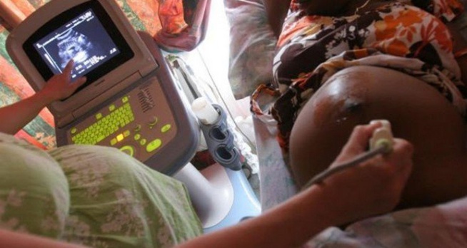 La légalisation de l’avortement divise médecins, ONG et religieux La légalisation de l’avortement divise médecins, ONG et religieux