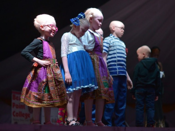 Un concours de beauté pour albinos pour lutter contre les préjugés