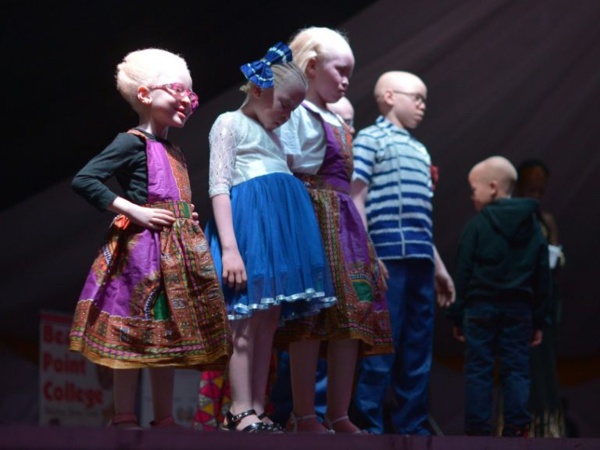 Un concours de beauté pour albinos pour lutter contre les préjugés Un concours de beauté pour albinos pour lutter contre les préjugés