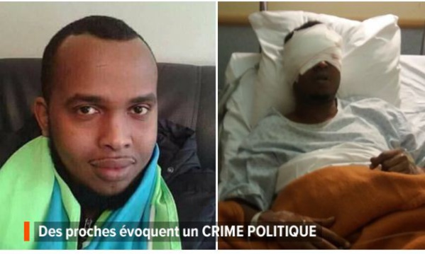 Un homme se fait "arracher" les yeux en pleine rue Un homme se fait "arracher" les yeux en pleine rue