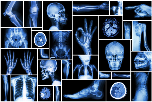 le 8 novembre, Journée internationale de la radiologie le 8 novembre, Journée internationale de la radiologie