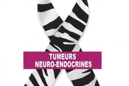 Ce 10 novembre, journée mondiale de sensibilisation aux tumeurs neuro-endocrines Ce 10 novembre, journée mondiale de sensibilisation aux tumeurs neuro-endocrines