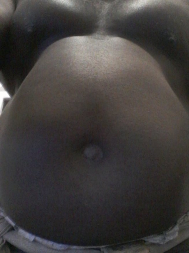 Appel à l'aide : « Mon ex-femme m’a transmise une maladie bizarre, j'ai l'impression d'avoir une grenouille dans mon ventre » Appel à l'aide : « Mon ex-femme m’a transmise une maladie bizarre, j'ai l'impression d'avoir une grenouille dans mon ventre »