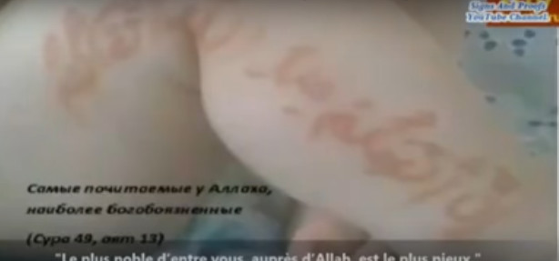 Vidéo : Le bébé russe né avec des versets coraniques sur le corps continue de drainer des foules Vidéo : Le bébé russe né avec des versets coraniques sur le corps continue de drainer des foules