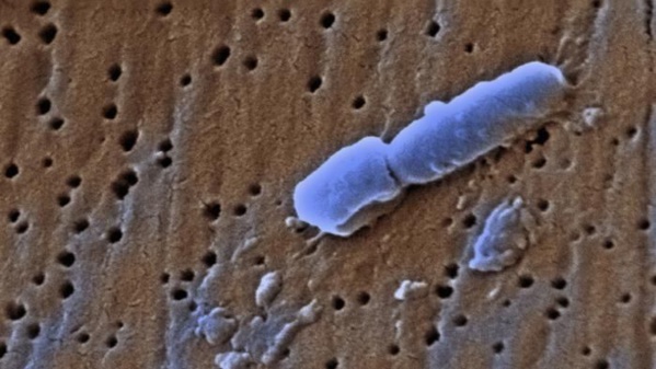 Une Américaine tuée par une bactérie résistante à 26 antibiotiques Une Américaine tuée par une bactérie résistante à 26 antibiotiques
