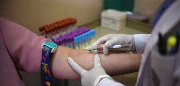 Drépanocytose: des chercheurs africains essaient un dépistage ultra-rapide et moins coûteux Drépanocytose: des chercheurs africains essaient un dépistage ultra-rapide et moins coûteux