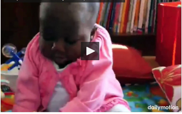 Côte d'Ivoire : cette petite fille est née avec 4 jambes et 2 colonnes vertébrales