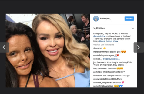 Photos-La leçon de courage de Katie Piper, une jeune femme défigurée à l'acide par son ex