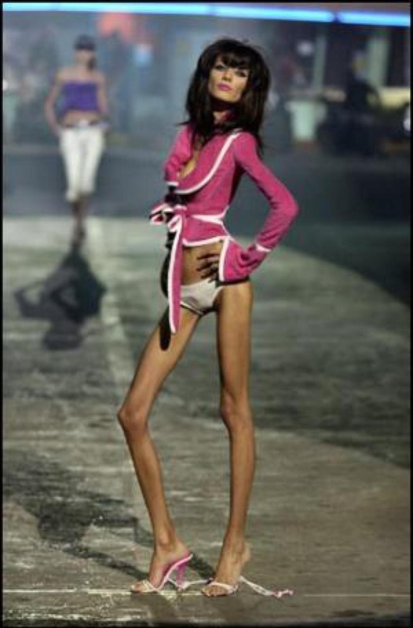 Un mannequin meurt d'anorexie, sa mère jette son corps à la mer dans une valise Un mannequin meurt d'anorexie, sa mère jette son corps à la mer dans une valise