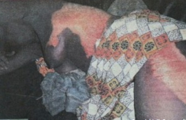 Drame : Adama Cissokho ébouillantée par sa coépouse a malheureusement rendu l’âme. Drame : Adama Cissokho ébouillantée par sa coépouse a malheureusement rendu l’âme.