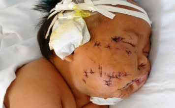 Son bébé la mord au sein pendant qu'elle l'allaite, puis ce qu'elle fait au bébé est monstrueux. Son bébé la mord au sein pendant qu'elle l'allaite, puis ce qu'elle fait au bébé est monstrueux.