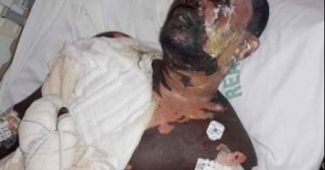 Matam: Un imam ébouillanté pour s’être excusé de diriger la «nafila » Matam: Un imam ébouillanté pour s’être excusé de diriger la «nafila »