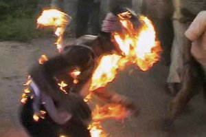 Niakhar : Largué par sa copine étudiante, il s’immole par le feu Niakhar : Largué par sa copine étudiante, il s’immole par le feu