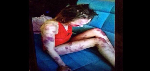 Russie: un homme bat sa femme à mort et filme la scène pour se vanter (photos) Russie: un homme bat sa femme à mort et filme la scène pour se vanter (photos)