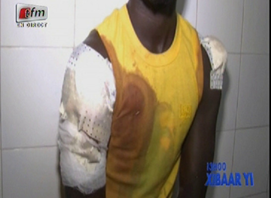Chambre criminelle de Dakar: SA JAMBE AMPUTÉE, SA TÊTE FRACASSÉE… Comment le fils du présidentde l’Association des maures du Sénégal a été cruellement agressé Chambre criminelle de Dakar: SA JAMBE AMPUTÉE, SA TÊTE FRACASSÉE… Comment le fils du présidentde l’Association des maures du Sénégal a été cruellement agressé