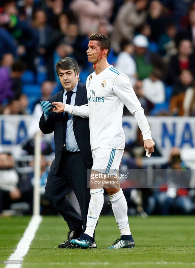 Blessure de Cristiano Ronaldo: Real Madrid Publie LA … Blessure de Cristiano Ronaldo: Real Madrid Publie LA …