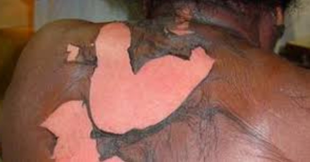Du jamais vu! Pour avoir un teint clair, les sénégalaises utilisent désormais du ciment Du jamais vu! Pour avoir un teint clair, les sénégalaises utilisent désormais du ciment