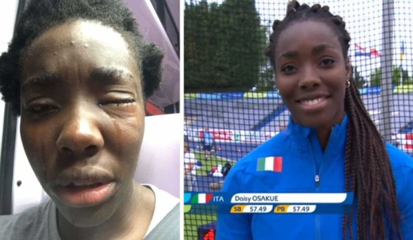 L’agression raciste d’une athlète noire choque l’Italie L’agression raciste d’une athlète noire choque l’Italie