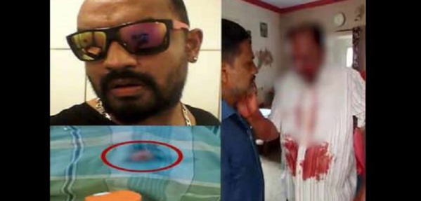 Horreur en Inde : Un homme crève l’œil de son père. La raison (vidéo) Horreur en Inde : Un homme crève l’œil de son père. La raison (vidéo)
