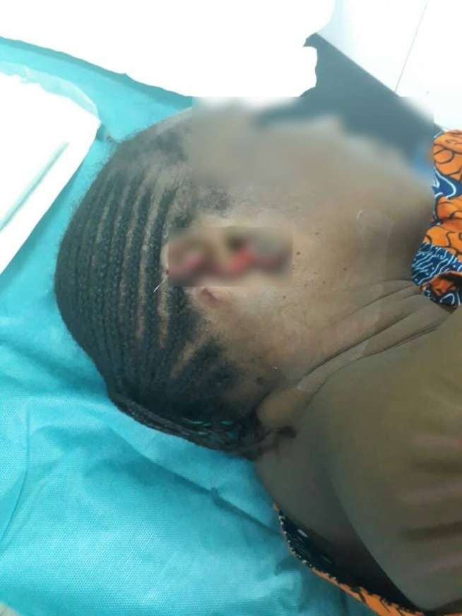 SCÈNE DE JALOUSIE: Avec l’aide de sa fille, la aawo arrache une oreille à sa coépouse… âme sensible SCÈNE DE JALOUSIE: Avec l’aide de sa fille, la aawo arrache une oreille à sa coépouse… âme sensible