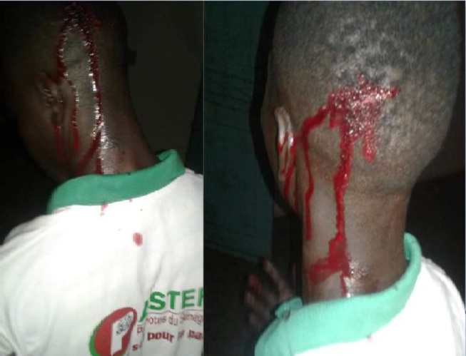 Fatick: l'attaque du Qg de PASTEF fait 2 blessés graves Fatick: l'attaque du Qg de PASTEF fait 2 blessés graves