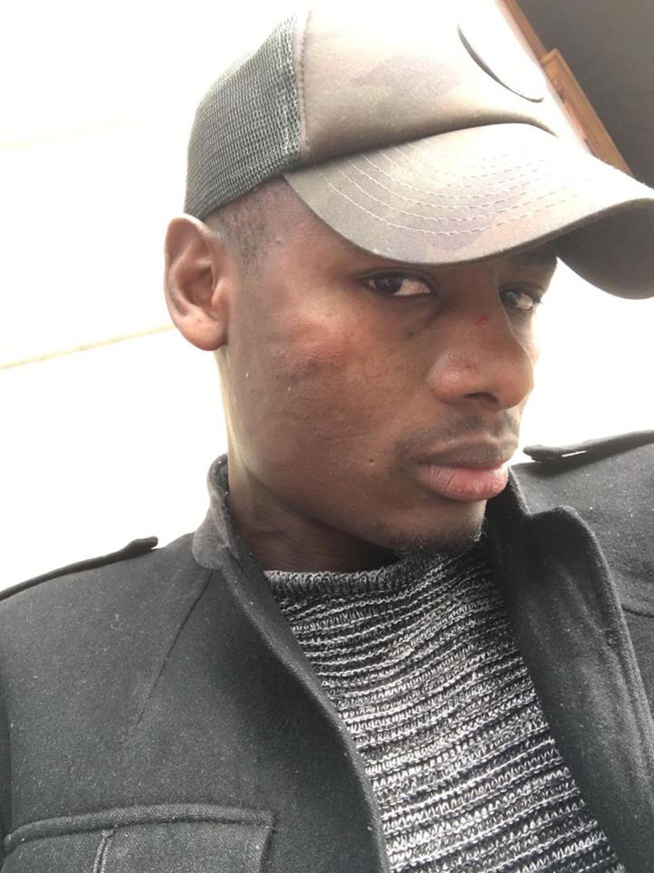 Abus d’autorité au Consulat du Senegal à Paris , deux citoyens Sénégalais violemment battus par des gendarmes.