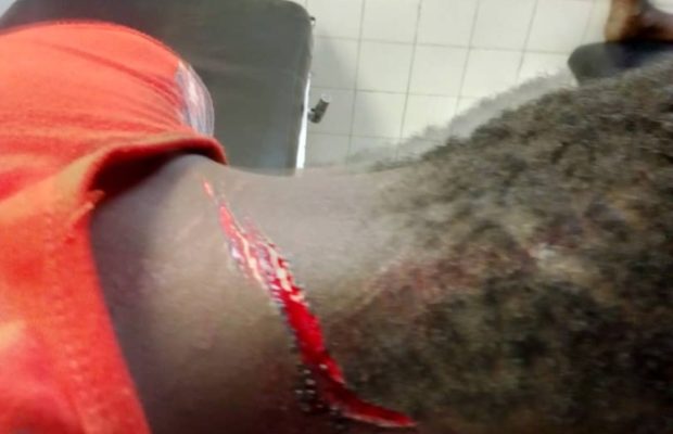 Thiès : M. Lèye échappe à ses agresseurs avec des blessures de 6 cm de profondeur