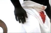 Elle mord l’appareil de son mari parce qu’il…