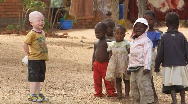 Un jeune homme de 28 ans a été condamné à mort, pour avoir tué un alibinos âgé de 19 ans pour s’enrichir. Un jeune homme de 28 ans a été condamné à mort, pour avoir tué un alibinos âgé de 19 ans pour s’enrichir.