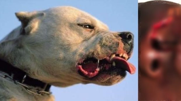 Attaqué par un pitbull : Ce qui n’a été dit sur la mésaventure du jeune Boubacar Baldé !