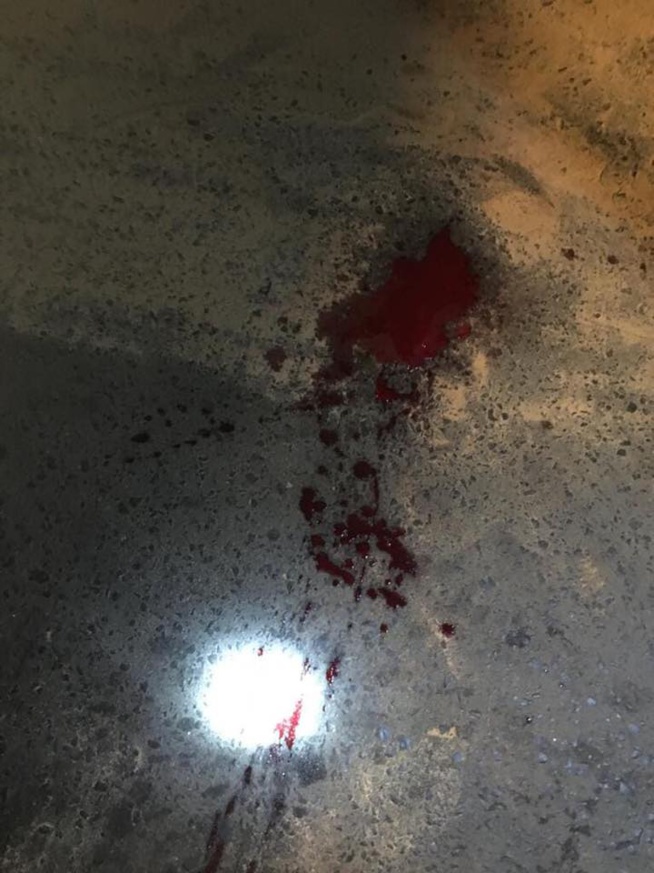 Guédiéwaye un taximan agressé encore par… ( Attention images sensibles ) Guédiéwaye un taximan agressé encore par… ( Attention images sensibles )