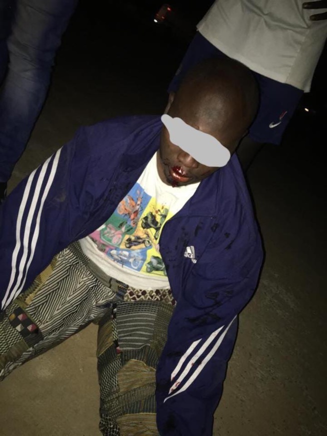 Guédiéwaye un taximan agressé encore par… ( Attention images sensibles ) Guédiéwaye un taximan agressé encore par… ( Attention images sensibles )
