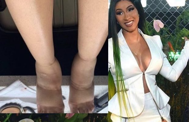 Cardi B: ses pieds et son ventre « très enflés » après des chirurgies esthétiques (photo)