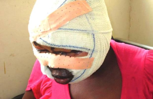 Kébémer : Une femme défigure sa coépouse avec de l’acide Kébémer : Une femme défigure sa coépouse avec de l’acide
