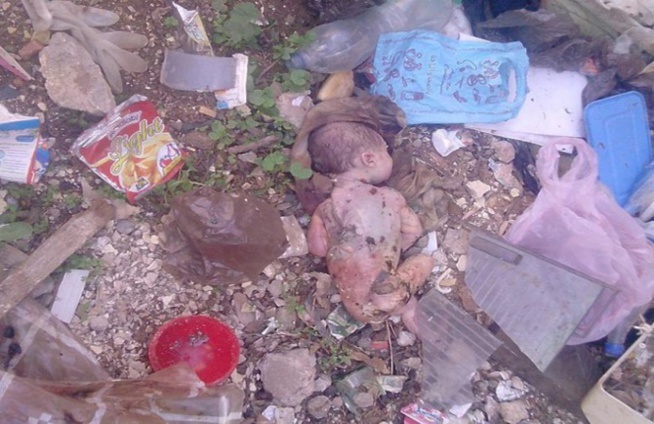 Infanticide à Rebeuss : Un nouveau-né découvert dans une fosse septique Infanticide à Rebeuss : Un nouveau-né découvert dans une fosse septique