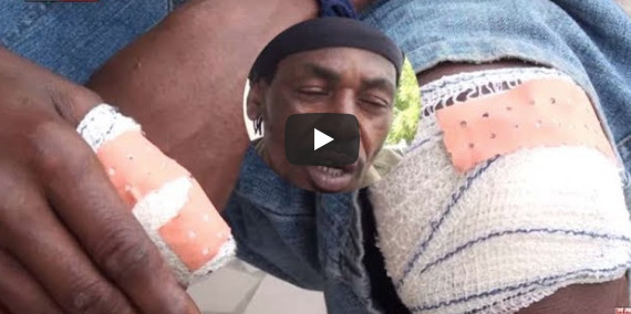 Vidéo : Le rappeur 10 000 Problèmes victime d’un terrible accident