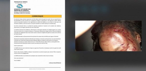 Sédhiou: Une sage-femme agressée par deux Kankourang Sédhiou: Une sage-femme agressée par deux Kankourang