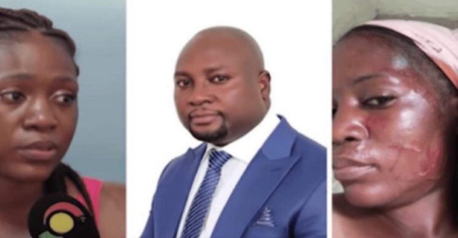 Ghana: Une femme battue par son amant marié et son épouse Ghana: Une femme battue par son amant marié et son épouse