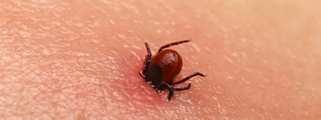 Alerte: Un cas de fièvre Crimée Congo enregistré à Kaolack Alerte: Un cas de fièvre Crimée Congo enregistré à Kaolack