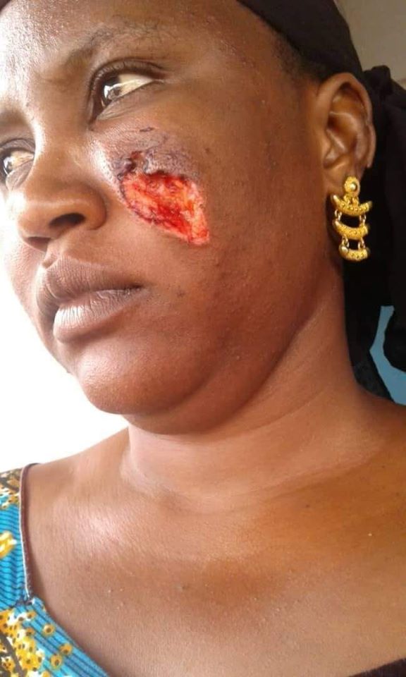 Ne pouvant plus supporter les cris de son bébé, il tabasse et mord sa femme à la joue Ne pouvant plus supporter les cris de son bébé, il tabasse et mord sa femme à la joue