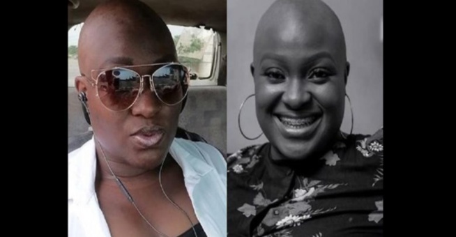 Adwowa Obeng, la ghanéenne qui n’a jamais eu de cheveux en 22 ans fait des confidences