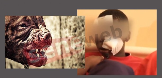 Linguère : Mordu par un chien, un talibé de 07 ans est entre la vie et la mort Linguère : Mordu par un chien, un talibé de 07 ans est entre la vie et la mort