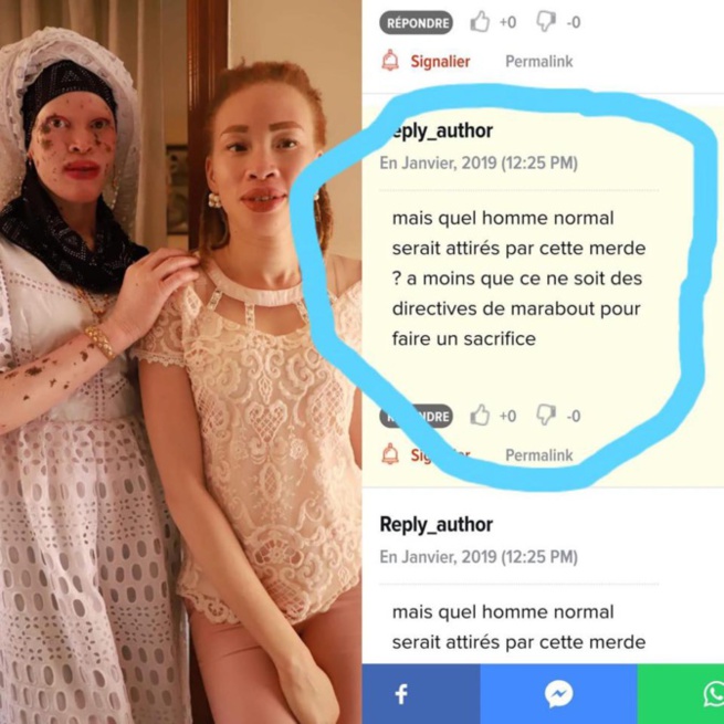 Commentaire injurieux sur les femmes Albinos, Ma keita se fâche et menace Commentaire injurieux sur les femmes Albinos, Ma keita se fâche et menace