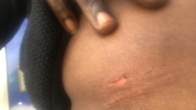 Banque Islamique, le vigile blesse une cliente en essayant de la sortir de force Banque Islamique, le vigile blesse une cliente en essayant de la sortir de force