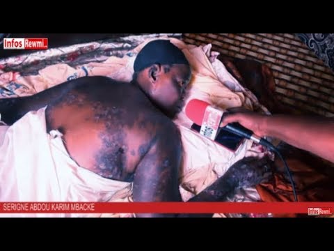 Ce qui arrive à Daba Gueye est vraiment triste (Âmes sensibles s’abstenir) Ce qui arrive à Daba Gueye est vraiment triste (Âmes sensibles s’abstenir)