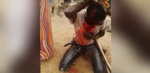 EN COMPAGNIE DE SES ENFANTS :Une femme attaquée par cinq agresseurs a Mermoz. EN COMPAGNIE DE SES ENFANTS :Une femme attaquée par cinq agresseurs a Mermoz.