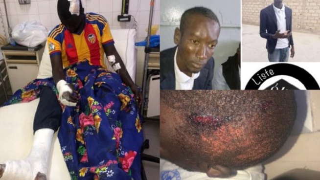 Les images insoutenables de la barbarie des étudiants de l’UCAD qui ont pris à parti un de leurs camarades au campus »Âmes sensibles »