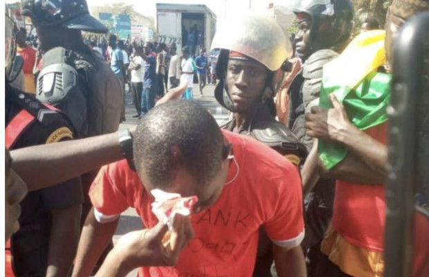 Jets de pierre à la manif « Nio lank » : des blessés, mais aucun étudiant arrêté Jets de pierre à la manif « Nio lank » : des blessés, mais aucun étudiant arrêté