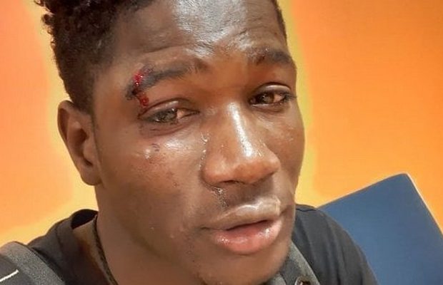 Italie : Agression raciste à Palerme, un Sénégalais battu et blessé