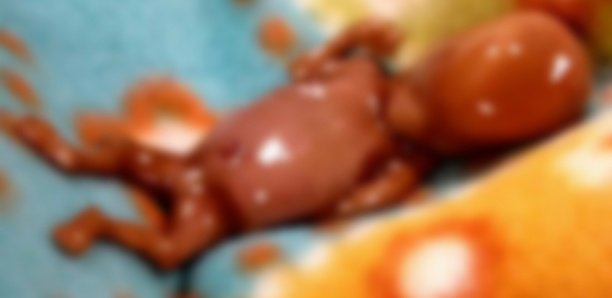 Avort*ment-Fausse c0uche: Un foetus retrouvé en face de la Rfm